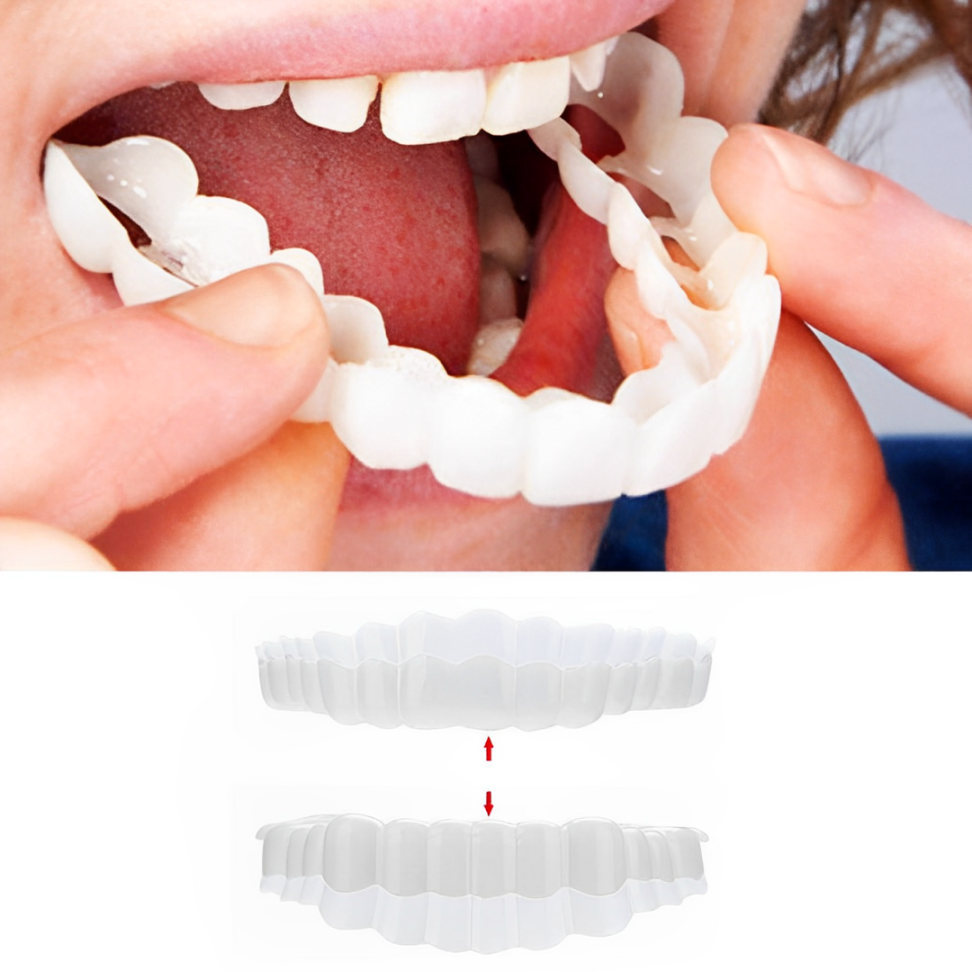 Snap-On Smile Veneers — Upper & Lower Teeth Cover Set 1